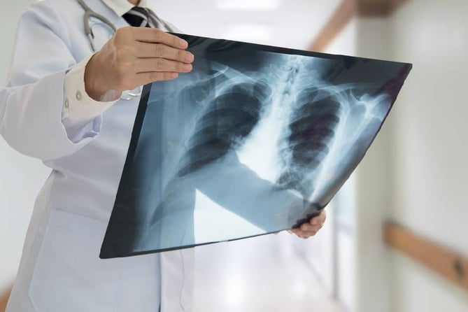 Types of X-Ray Services